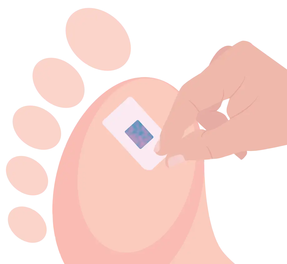 Carefully remove the pad from your foot, taking care not to touch the coloured central rectangle.