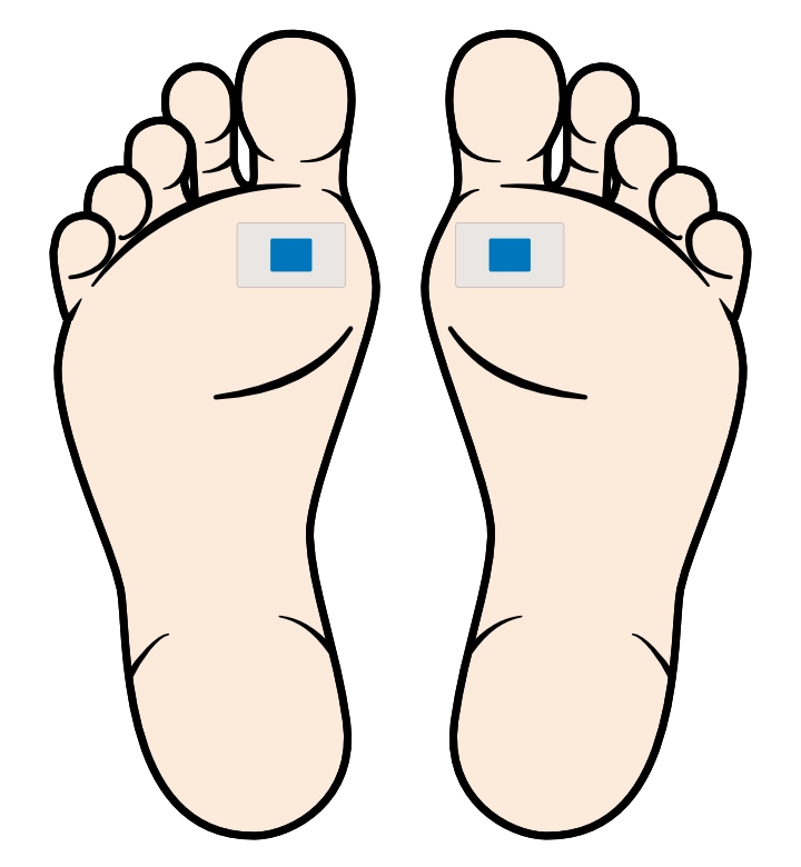 Diagram showing the correct application of a sudomotor (sweat) function test (SFT) on both feet